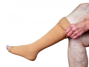 Herken een Trombosebeen