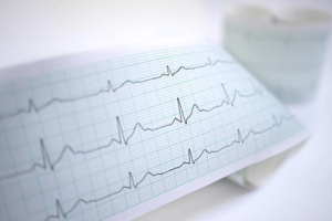 ecg hart